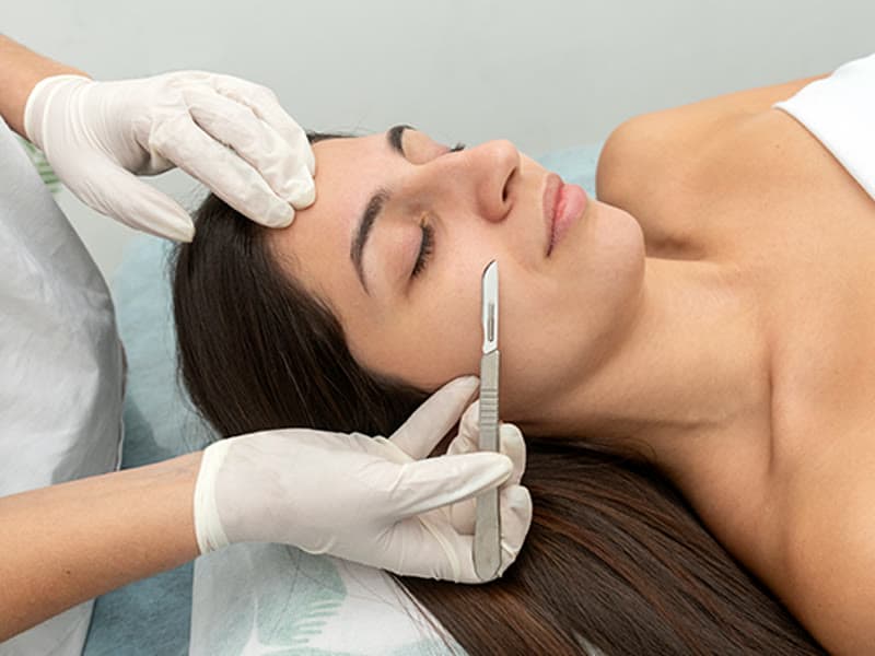 Dermaplaning — Express
