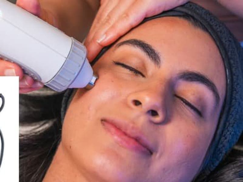 Radiofrequency (RF) — Face