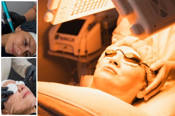 Repair and  Glow – Microneedling (Dr. Pen)