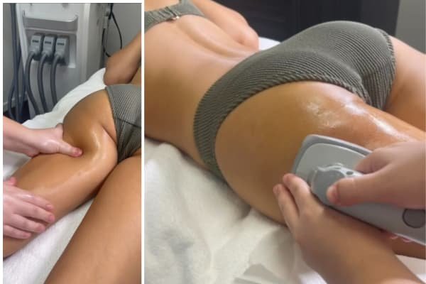 Lower Body Lymphatic + Contouring (Anti-Cellulite)