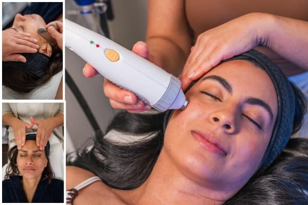 Full Face Lifting (Non-Invasive RF)