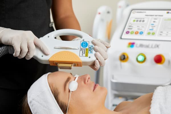Intense Pulsed Light (IPL)