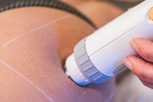 Radio Frequency (skin tightening)
