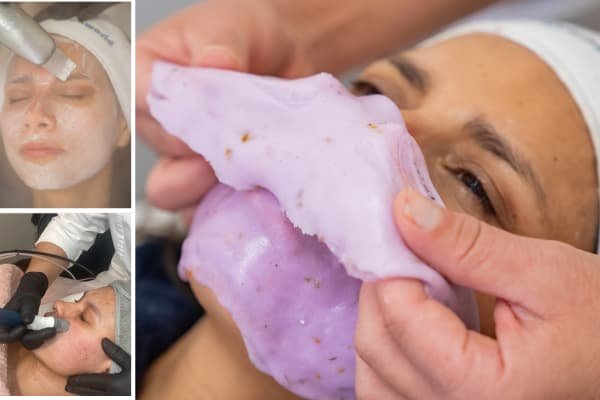 Acne Deep Exfoliation & Renewal