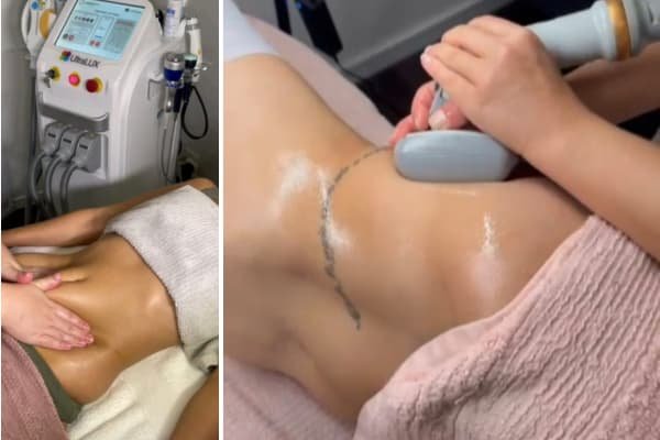 Upper Body Lymphatic + Contouring