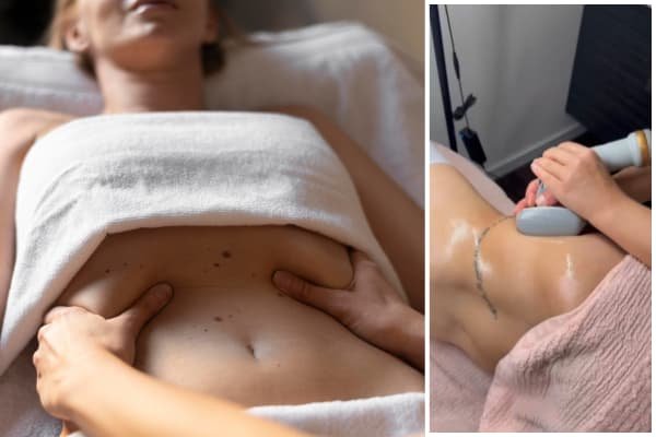 Tummy Tuck + ABS High Definition