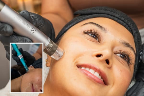 Add-on Microneedling – Dr Pen