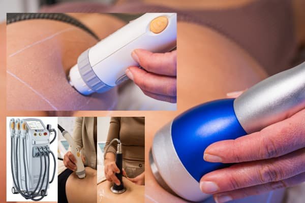 Radiofrequency (RF) – Body