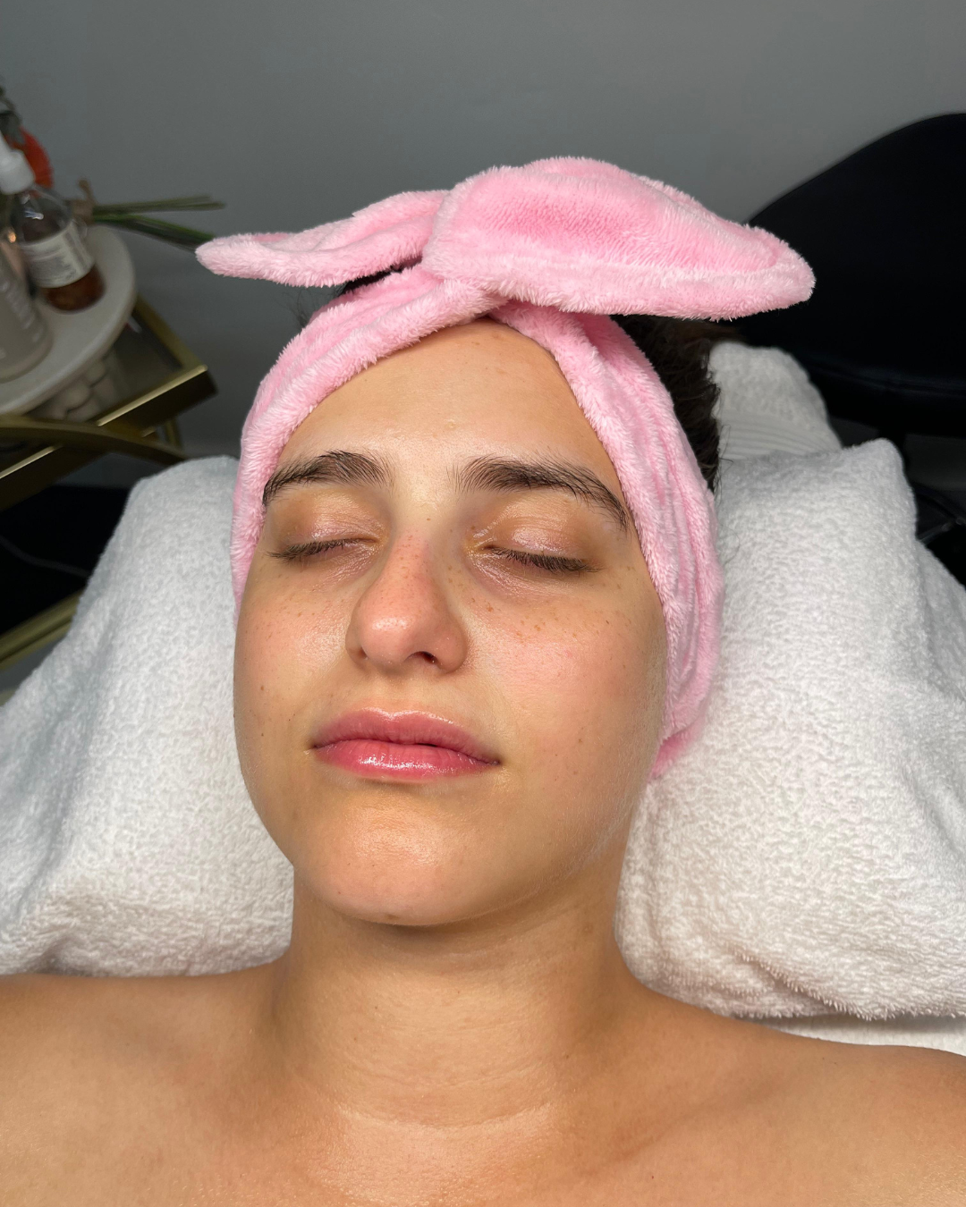 Post-Treatment Glow Result