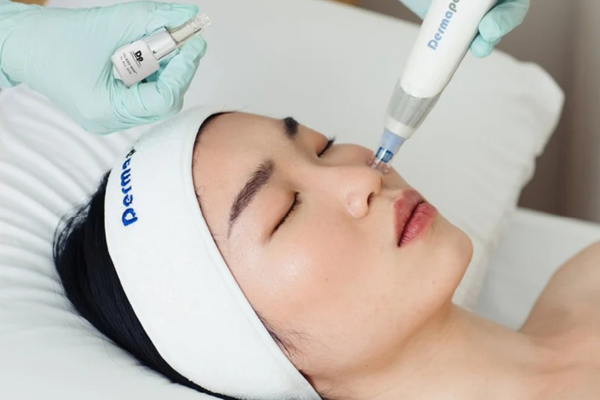 Dermapen 4 Exosomes Facial Treatment